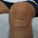 Verletzung am Knie